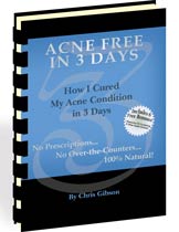 How to get rid of your acne in 3 days